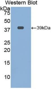 Osteocalcin Antibody (aa21-99)