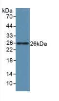 Human LIF Protein (Recombinant His, N-Terminal)