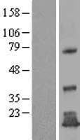 TMEM125 Protein (Over-Expression Lysate Myc-DDK (Flag))