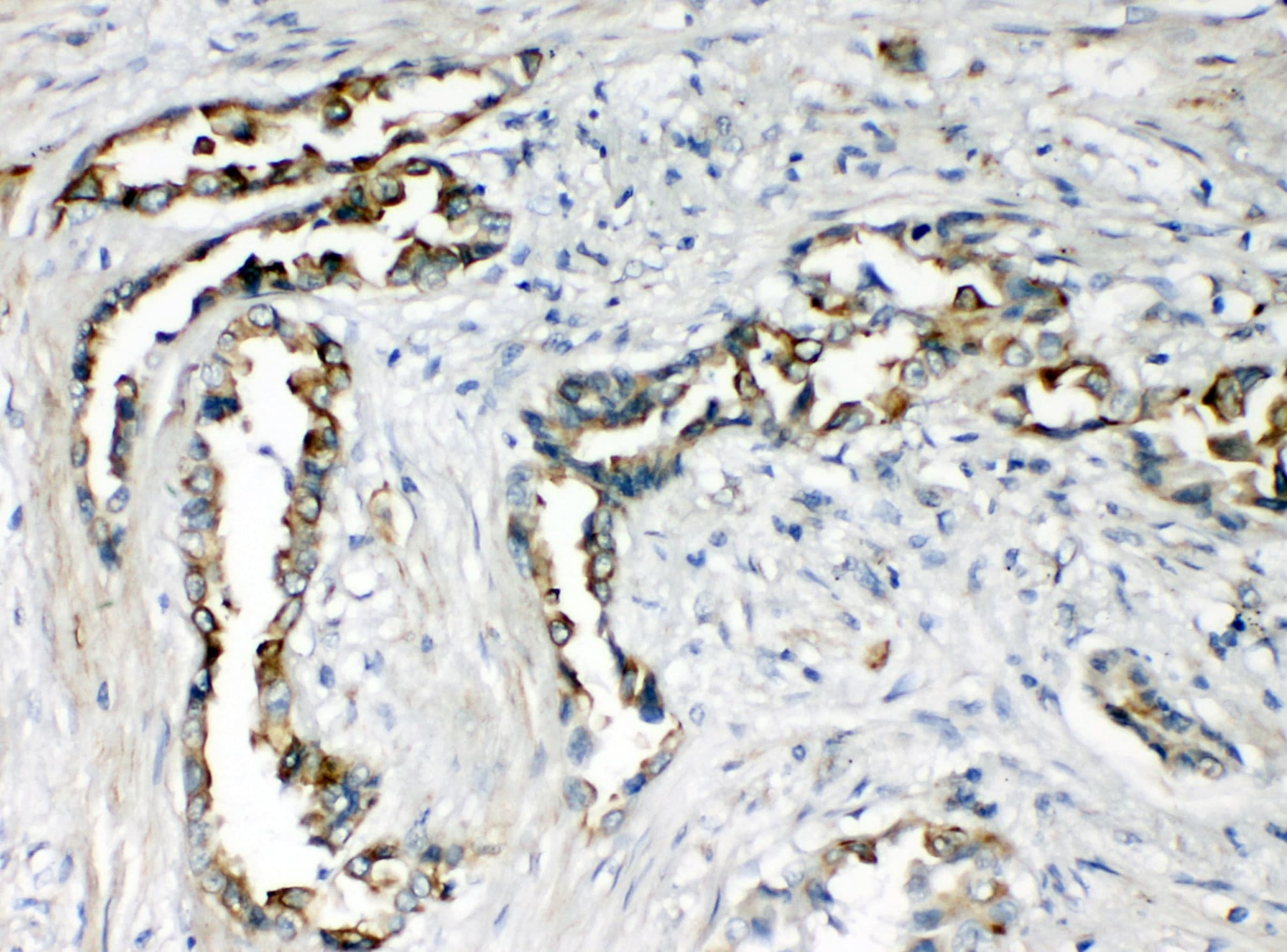 CXCR1 Antibody (aa24-38)