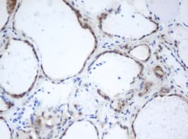 PRR11 Antibody (aa125-360, clone OTI3C8)