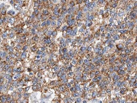 CSTB / Cystatin B / Stefin B Antibody