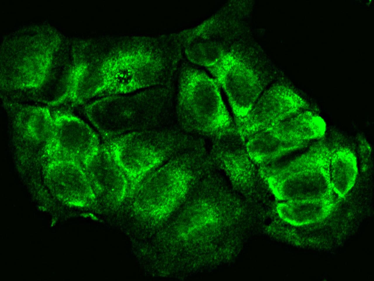 CD79B / CD79 Beta Antibody (Preservative Free)