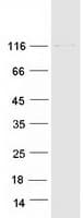 Human ERN1 / IRE1 Protein (Recombinant Myc-DDK (Flag))