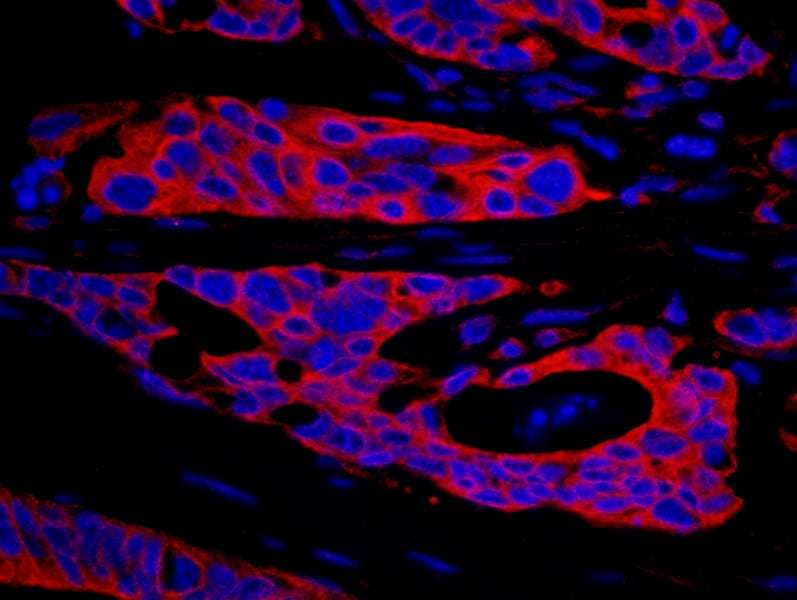 Polyclonal Rabbit anti-Human STK39 / SPAK Antibody (aa425-450, IHC)