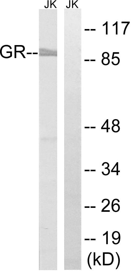 IHC-plus™ NR3C1/Glucocorticoid Receptor Antibody (aa171-220)