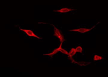 Polyclonal Rabbit anti-Human PTGER4 / EP4 Antibody (IF, WB)