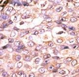 DUSP7 Antibody (aa96-127)