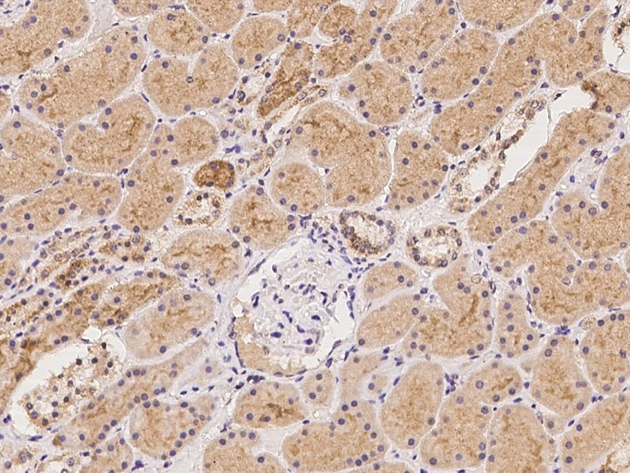Polyclonal Rabbit anti-Human SLC38A3 / SNAT3 Antibody (IHC)