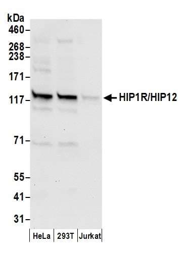 HIP1R Antibody (aa1018-1068)