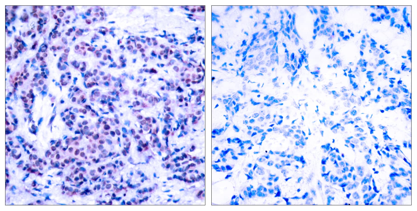 AP-1 / JUND Antibody (phospho-Ser255)