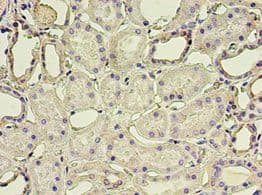 GSN / Gelsolin Antibody (aa28-782)