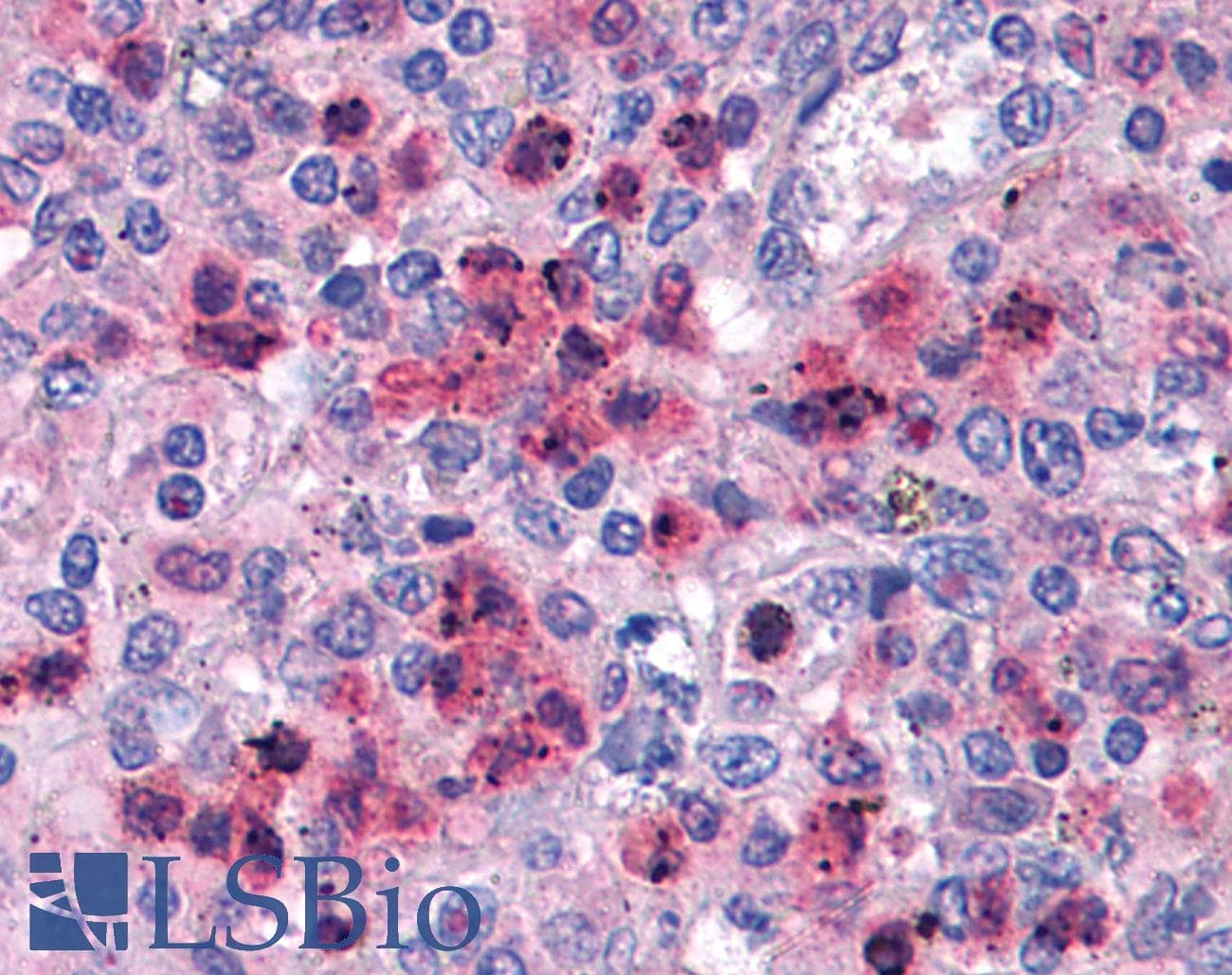 IHC-plus™ IRF4 Antibody (clone 2F2)
