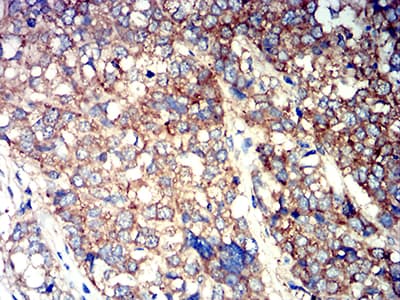 Monoclonal Mouse anti-Human ATG3 Antibody (clone 7A1D1, IHC, WB)