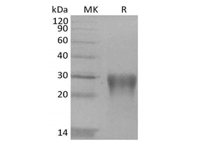 Human TGFB1 / TGF Beta 1 Protein (Recombinant)