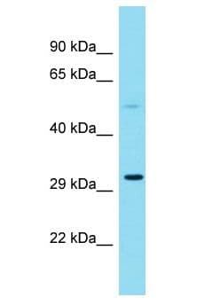 Polyclonal Rabbit anti-Human DNAM-1 / CD226 Antibody (aa225-274, IHC, WB)
