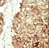 FGFR2 / FGF Receptor 2 Antibody (aa794-821)