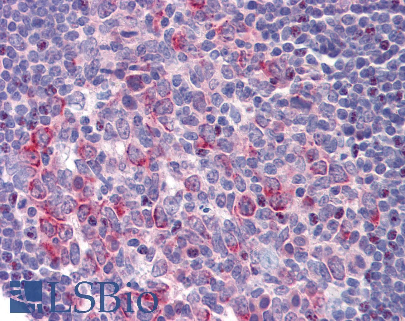 CXCR2 Antibody (N-Terminus)