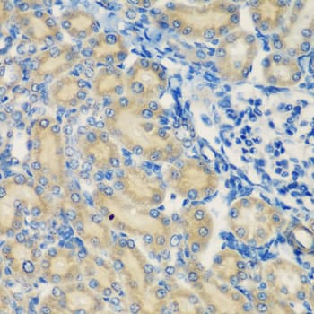 Complement C1s Antibody