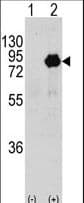 PIK3R2 / p85 Beta Antibody (Tyr464)