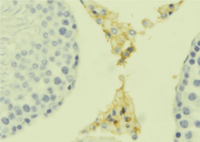 C1QTNF8 / CTRP8 Antibody