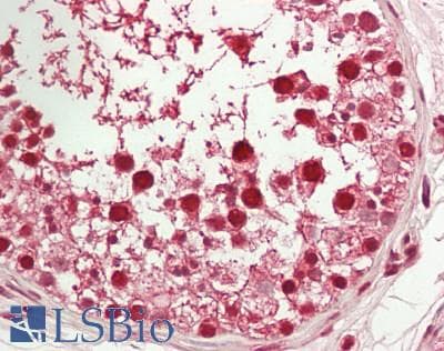 IHC-plus™ NFYA Antibody (aa320-333)