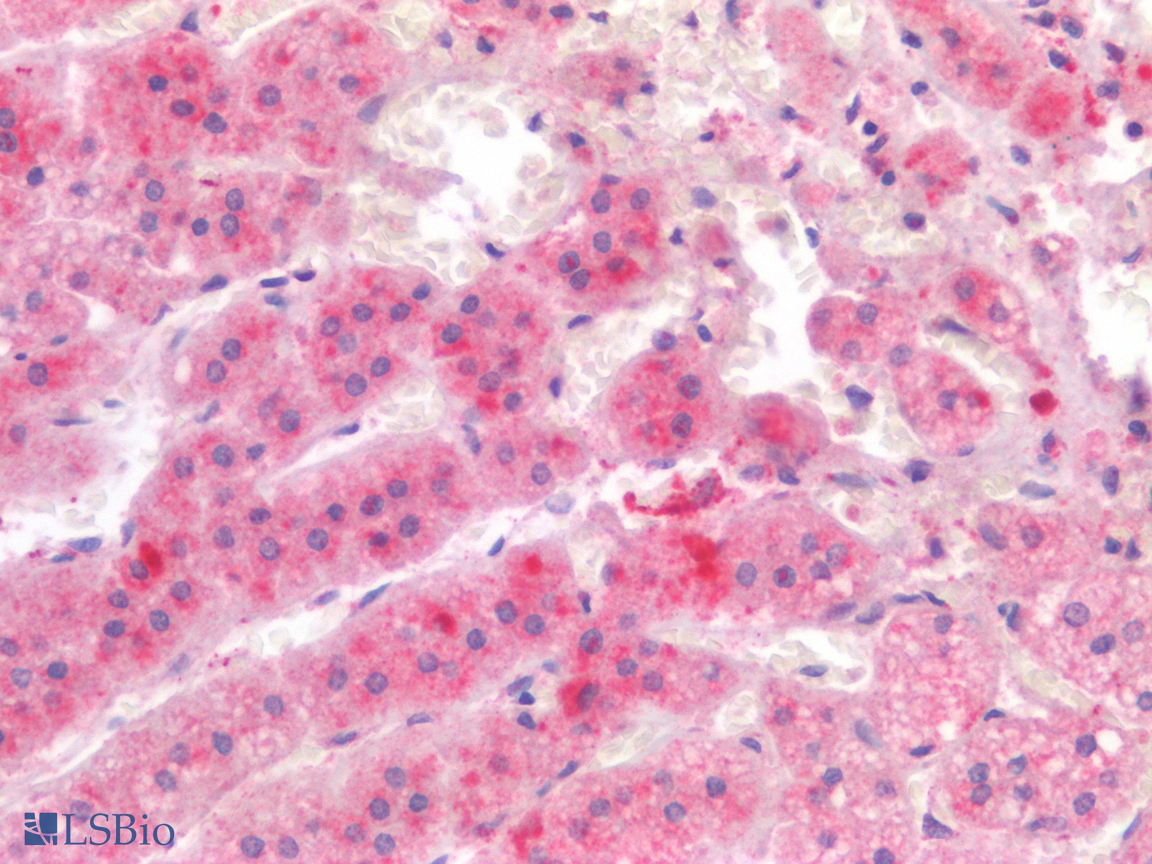 PathPlus™ IL17A Antibody