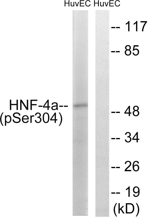 HNF4A / HNF4 Antibody (phospho-Ser313)