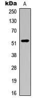 AUTL1 / ATG4C Antibody (N-Terminus)