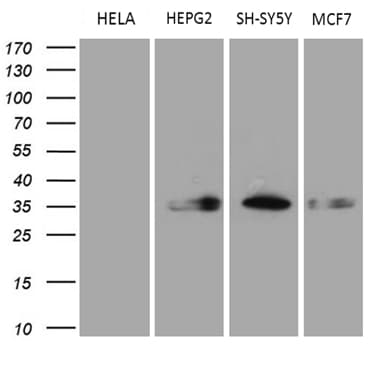 CBR / CBR1 Antibody (clone OTI4B4)
