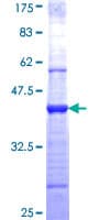 Human WIF1 Protein (Recombinant GST, N-terminus)