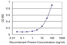 SCGB1A1 / Uteroglobin Antibody (clone 1F7)