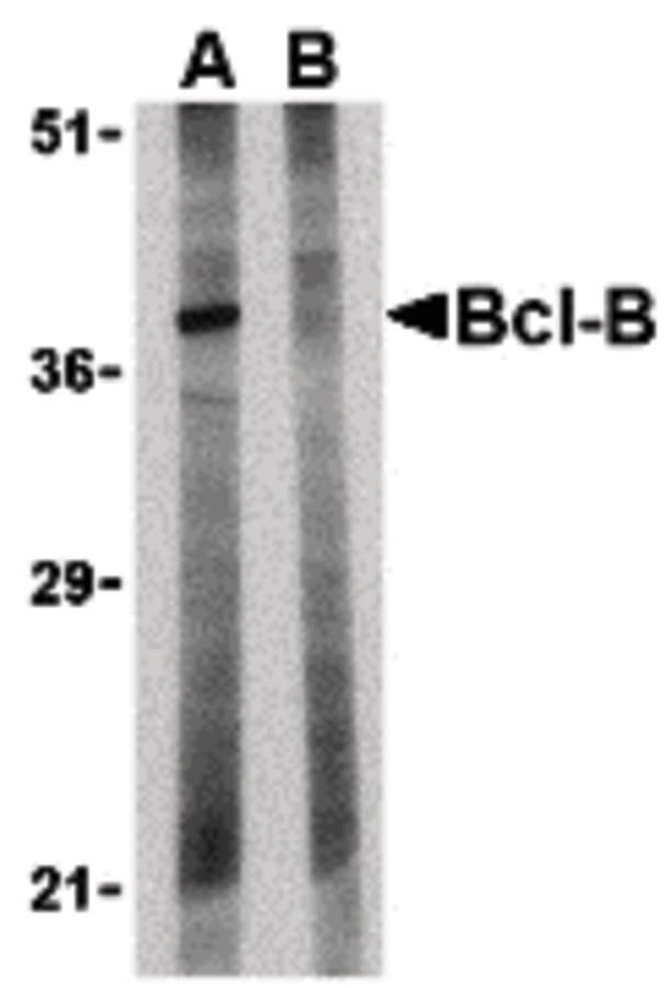 IHC-plus™ BCL2L10 / Diva Antibody