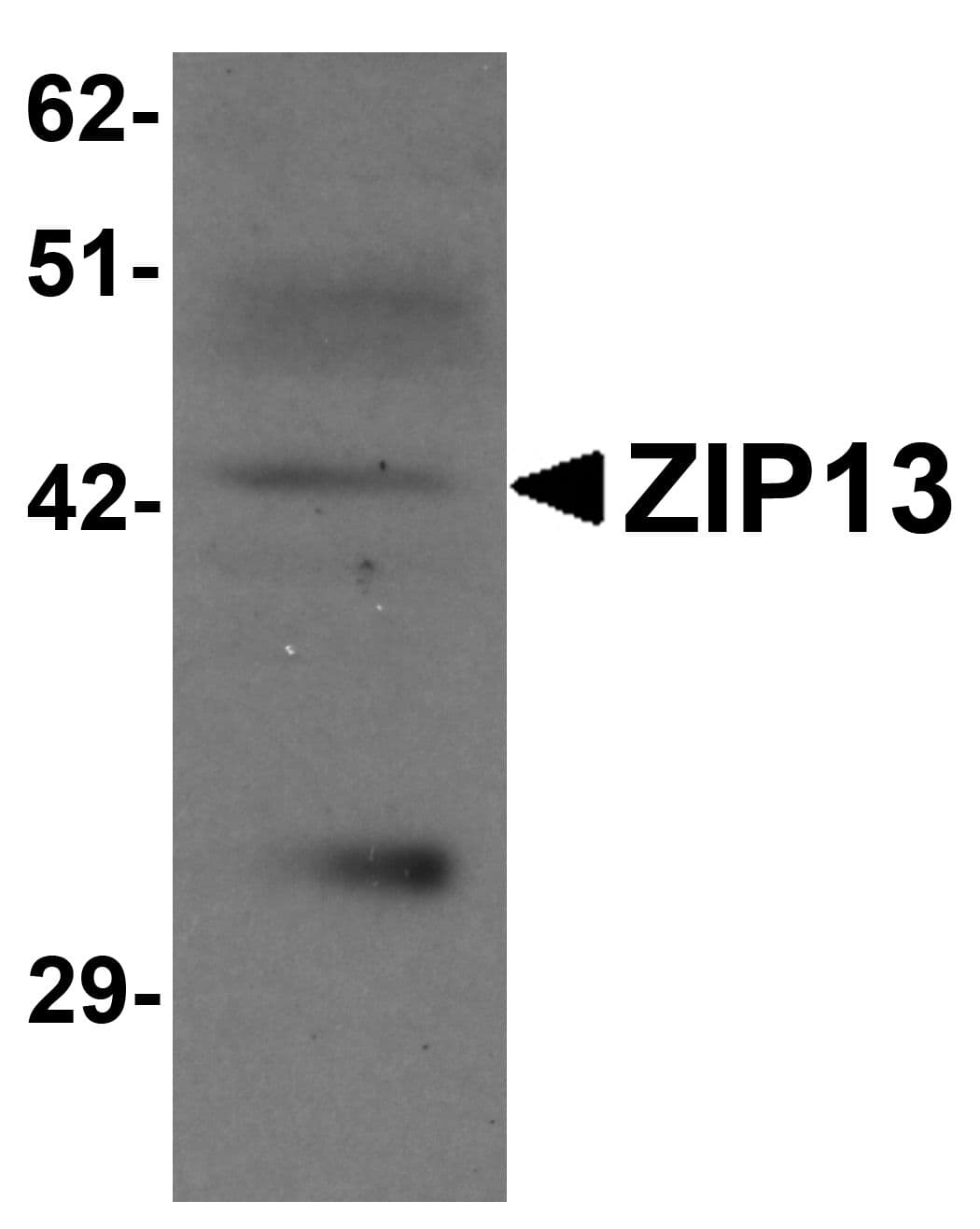 Polyclonal Rabbit anti-Human SLC39A13 / ZIP13 Antibody (IHC, IF, WB)