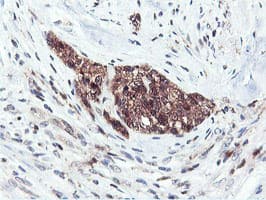 RNPEP Antibody (clone OTI2G3)