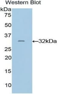 GRAP2 / GRID Antibody (aa20-262)