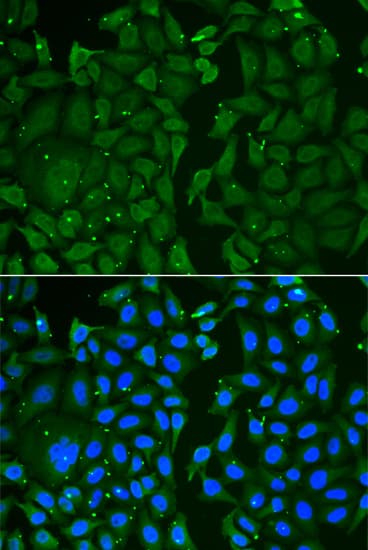 TKT / Transketolase Antibody