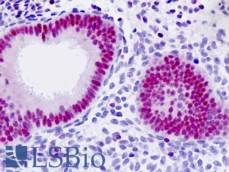 IHC-plus™ CDKN1A / WAF1 / p21 Antibody (aa111-160)