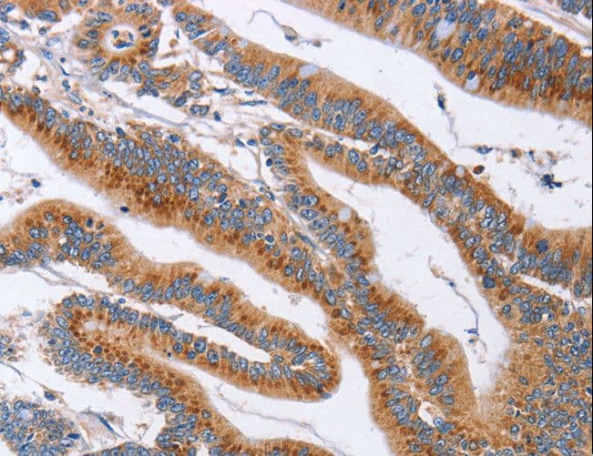 Polyclonal Rabbit anti-Human SIGLEC6 Antibody (IHC)