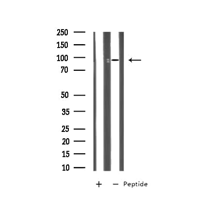 MTA1 Antibody
