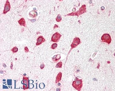 IHC-plus™ RPL30 / Ribosomal Protein L30 Antibody (aa62-111)