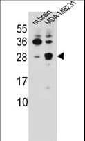 CBLN2 / Cerebellin 2 Antibody (aa179-207)