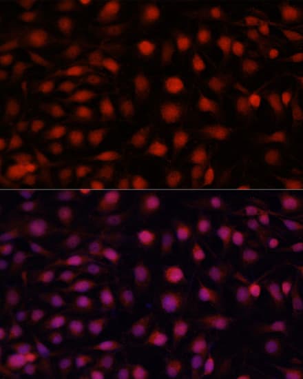 Polyclonal Rabbit anti-Human NOS3 / eNOS Antibody (IF, WB)