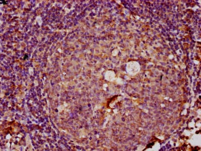 LTN1 / RNF160 Antibody