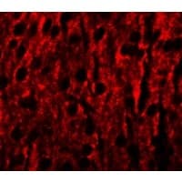 IHC-plus™ RILPL1 Antibody