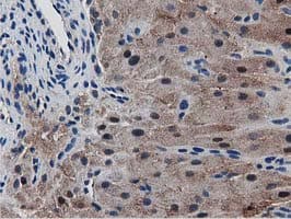 Monoclonal Mouse anti-Human SQSTM1 Antibody (clone OTI4E2, IHC, IF, WB)