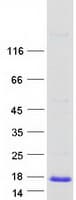 Human MSMP Protein (Recombinant Myc-DDK (Flag))