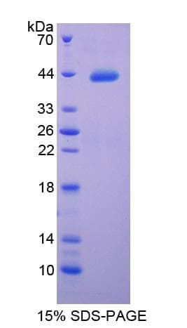 Human Complement C4 Protein (Recombinant His-T7)