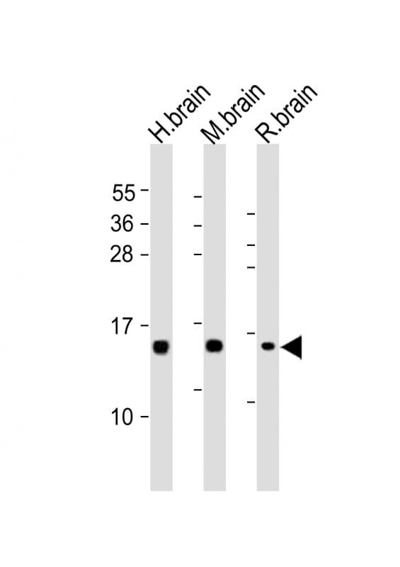 Polyclonal Rabbit anti-Human NRGN / Neurogranin Antibody (aa49-81, WB)