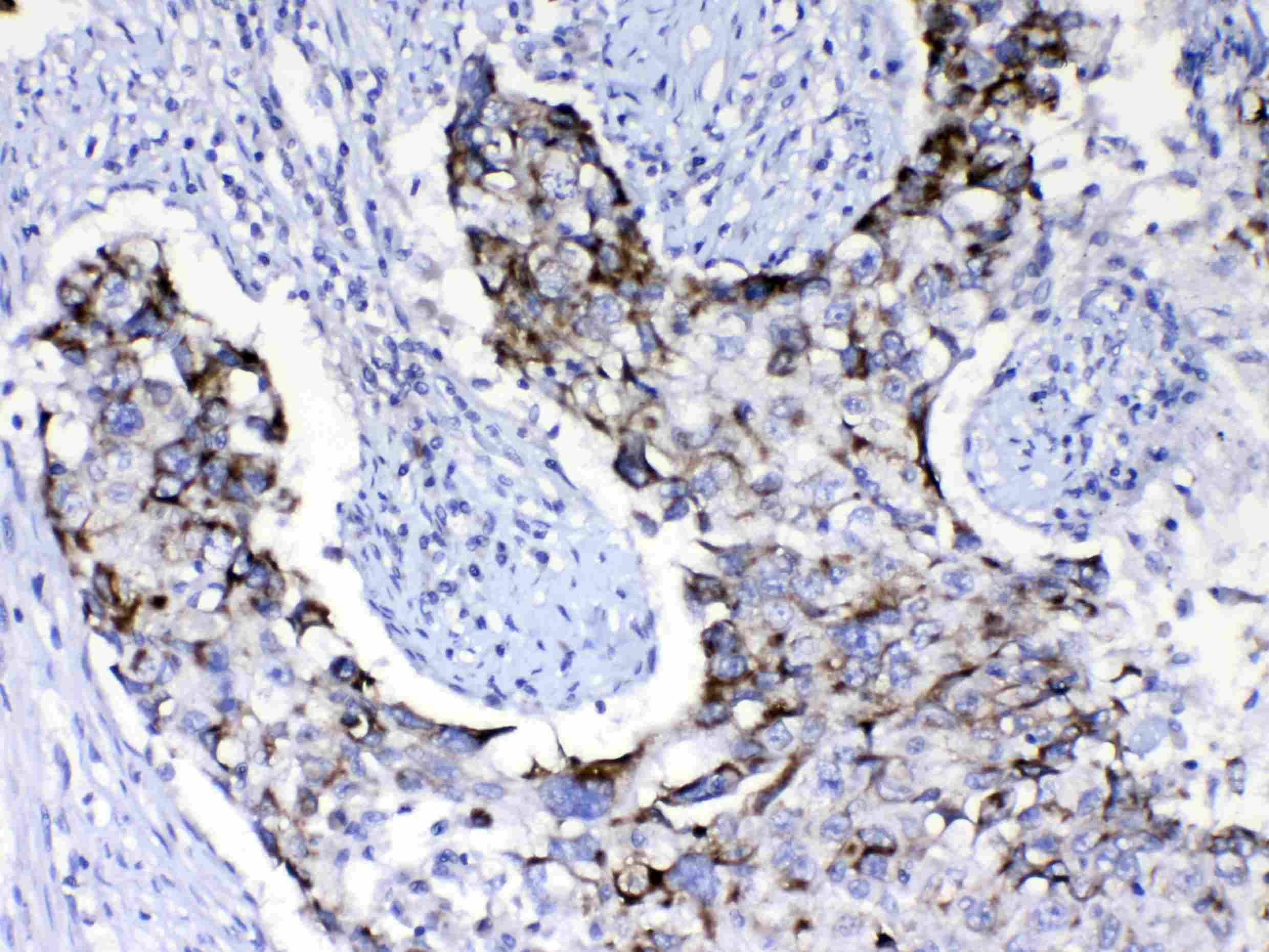 PIK3CB / PI3K Beta Antibody